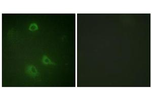 Immunofluorescence analysis of A549 cells, using NMDAR1 (Phospho-Ser890) antibody. (GRIN1/NMDAR1 抗体  (pSer890))