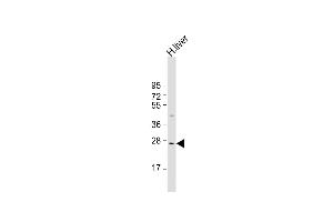 Anti-IGFBP-3- Antibody at 1:1000 dilution + human liver lysate Lysates/proteins at 20 μg per lane. (IGFBP3 抗体  (AA 162-189))