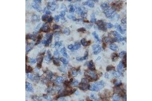 Immunohistochemical analysis of LCK staining in human lymph node formalin fixed paraffin embedded tissue section. (LCK 抗体)