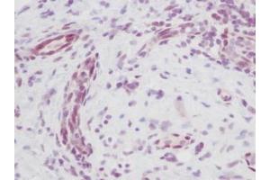 Image no. 5 for anti-Melanoma Inhibitory Activity (MIA) antibody (ABIN464851) (MIA 抗体)