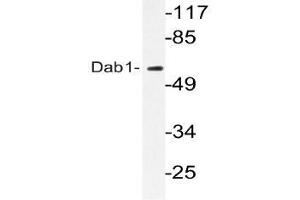 Western blot (WB) analyzes of Dab1 antibody in extracts from HeLa cells. (DAB1 抗体)