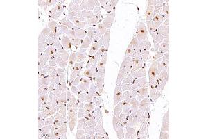 Immunohistochemistry of paraffin embedded rat heart using TFIIIC110 (ABIN7074038) at dilution of 1:2500 (400x lens) (GTF3C2 抗体)