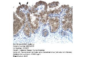 Human Intestine (Asialoglycoprotein Receptor 2 抗体  (N-Term))