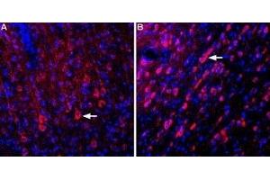 Expression of Glutamate receptor δ1 in rat cortex and medial septum - Immunohistochemical staining of perfusion-fixed frozen rat brain sections using Anti-GRID1 (extracellular) Antibody (ABIN7043235, ABIN7044374 and ABIN7044375), (1:400). (GRID1 抗体  (Extracellular, N-Term))
