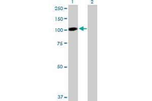 Western Blotting (WB) image for anti-Signal Transducer and Activator of Transcription 6, Interleukin-4 Induced (STAT6) (AA 1-847) antibody (ABIN520550)