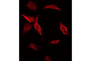 ABIN6272672 staining HT-29 by IF/ICC. (HTR3D 抗体)