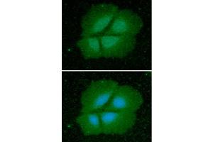 ICC/IF analysis of Cyclophilin B in Hep3B cells line, stained with DAPI (Blue) for nucleus staining and monoclonal anti-human Cyclophilin B antibody (1:100) with goat anti-mouse IgG-Alexa fluor 488 conjugate (Green). (PPIB 抗体  (AA 26-216))