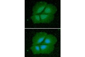 ICC/IF analysis of Cyclophilin B in Hep3B cells line, stained with DAPI (Blue) for nucleus staining and monoclonal anti-human Cyclophilin B antibody (1:100) with goat anti-mouse IgG-Alexa fluor 488 conjugate (Green). (PPIB 抗体)