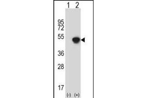 Western blot analysis of GCAT (arrow) using rabbit polyclonal GCAT Antibody (N-term) (ABIN656823 and ABIN2846034). (GCAT 抗体  (N-Term))