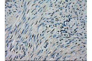 Immunohistochemical staining of paraffin-embedded endometrium tissue using anti-CRYABmouse monoclonal antibody. (CRYAB 抗体)