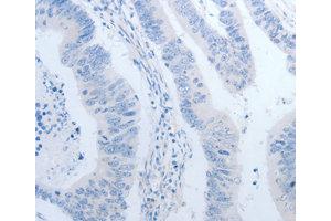 Immunohistochemistry (IHC) image for anti-Neurogenin 1 (NEUROG1) antibody (ABIN1873884) (Neurogenin 1 抗体)