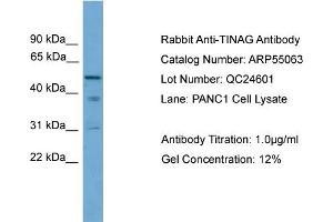 WB Suggested Anti-TINAG  Antibody Titration: 0. (TINAG 抗体  (Middle Region))