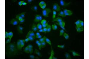 Immunofluorescence staining of MCF-7 cells with ABIN7171412 at 1:266, counter-stained with DAPI. (TCP1 alpha/CCTA 抗体  (AA 406-506))