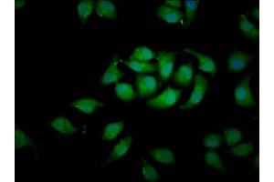 Immunofluorescence staining of A549 cells with ABIN7167130 at 1:100, counter-stained with DAPI. (RASSF3 抗体  (AA 2-109))