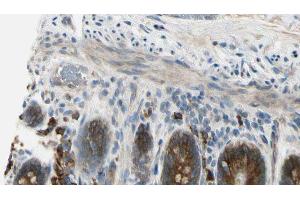 ABIN6274510 at 1/100 staining Mouse intestine tissue by IHC-P. (Sema4a 抗体  (Internal Region))