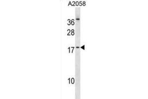 Western Blotting (WB) image for anti-Nescient Helix Loop Helix 2 (NHLH2) antibody (ABIN2998885) (NHLH2 抗体)