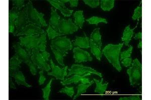 Immunofluorescence of monoclonal antibody to KRAS on HeLa cell.
