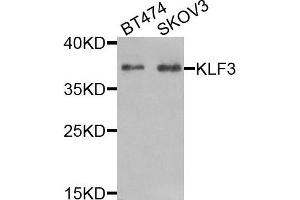 Western blot analysis of extracts of BT474 and SKOV3 cells, using KLF3 antibody. (KLF3 抗体)