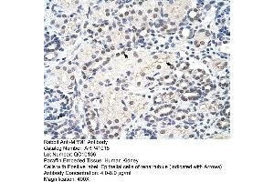 Rabbit Anti-MRM1 Antibody  Paraffin Embedded Tissue: Human Kidney Cellular Data: Epithelial cells of renal tubule Antibody Concentration: 4. (MRM1 抗体  (C-Term))
