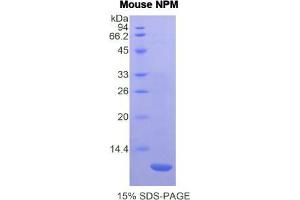 SDS-PAGE analysis of Mouse Nucleophosmin Protein. (NPM1 蛋白)
