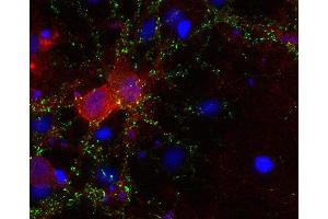 Indirect immunostaining of PFA fixed rat hippocampus neurons with anti-GAT 3 (dilution 1 : 500; red) and mouse anti-synapsin 1 (, dilution 1 : 1000; green).