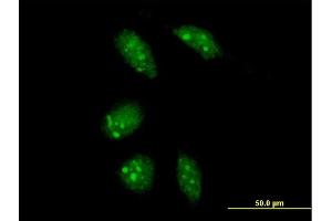Immunofluorescence of purified MaxPab antibody to GLTSCR2 on HeLa cell. (GLTSCR2 抗体  (AA 1-478))