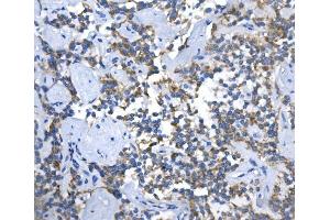 IHC analysis of ASS1 using anti-ASS1 antibody (ABIN7601190). (ASS1 抗体  (AA 3-365))