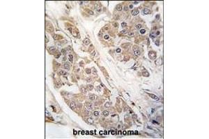 Immunohistochemistry (Paraffin-embedded Sections) (IHC (p)) image for anti-CTD (Carboxy-terminal Domain, RNA Polymerase II, Polypeptide A) Small Phosphatase 2 (CTDSP2) (AA 12-42), (N-Term) antibody (ABIN392885)