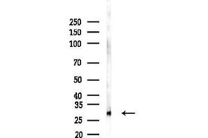anti-Chromosome 19 Open Reading Frame 52 (C19ORF52) (C-Term) antibody