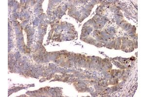 IHC analysis of Cystatin C/CST3 using anti-Cystatin C/CST3 antibody (ABIN6719299). (CST3 抗体  (AA 31-146))