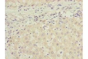 Immunohistochemistry of paraffin-embedded human liver tissue using ABIN7165663 at dilution of 1:100 (PHF17 抗体  (AA 543-842))