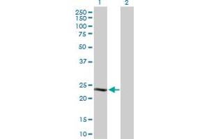 Western Blot analysis of CSN1S1 expression in transfected 293T cell line by CSN1S1 MaxPab polyclonal antibody. (Casein alpha S1 抗体  (AA 1-185))