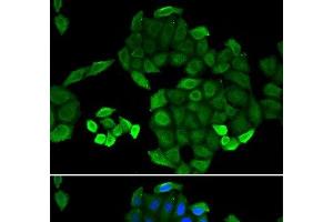 Immunofluorescence analysis of MCF-7 cells using PTS Polyclonal Antibody (PTS 抗体)