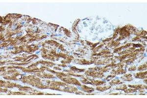 Immunohistochemistry (Paraffin-embedded Sections) (IHC (p)) image for anti-phosphodiesterase 3A, cGMP-Inhibited (PDE3A) antibody (ABIN7259753)