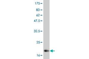 Western Blot detection against Immunogen (21 KDa) . (IL-6 抗体  (AA 29-212))
