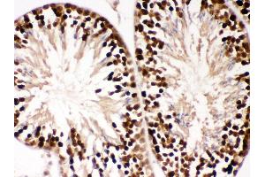 Anti- PBK Picoband antibody, IHC(P) IHC(P): Mouse Testis Tissue (PBK 抗体  (AA 71-322))