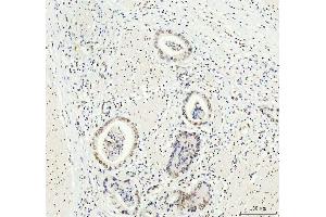 IHC analysis of DDX1 using anti-DDX1 antibody (ABIN7602050). (DDX1 抗体  (AA 562-740))