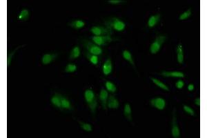 Immunofluorescence staining of Hela cells with nforHU at 1:12. (HIST1H1C 抗体)