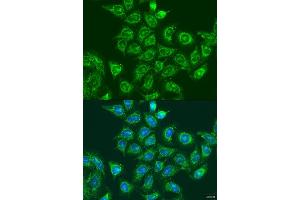 Immunofluorescence analysis of U2OS cells using UBE2A antibody (ABIN6132759, ABIN6149781, ABIN6149783 and ABIN6216187) at dilution of 1:100. (UBE2A 抗体  (AA 1-152))