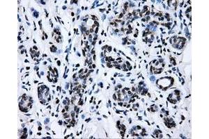 Immunohistochemical staining of paraffin-embedded breast tissue using anti-RALBP1 mouse monoclonal antibody. (RALBP1 抗体)