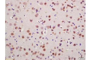 Formalin-fixed and paraffin embedded mouse brain labeled with Rabbit Anti-Glutamine synthetase Polyclonal Antibody, Unconjugated (ABIN754468) at 1:200 followed by conjugation to the secondary antibody and DAB staining (GLN1 抗体  (AA 285-373))
