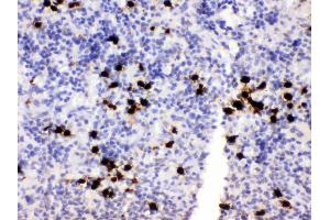 Anti- MRP8 Picoband antibody, IHC(P) IHC(P): Rat Spleen Tissue (S100A8 抗体  (AA 2-89))