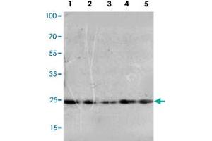 Western blot analysis of whole cell extracts with FGF10 polyclonal antibody . (FGF10 抗体  (N-Term))