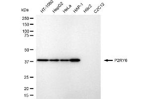 Western blotting analysis using P2RY6 antibody (ABIN7800076).