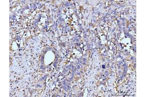IHC analysis of GLUL using anti-GLUL antibody (ABIN7602403).
