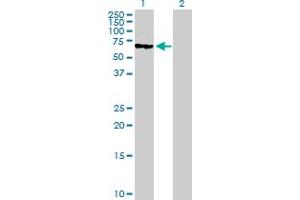 Western Blot analysis of MUTYH expression in transfected 293T cell line by MUTYH MaxPab polyclonal antibody. (MUTYH 抗体  (AA 1-535))