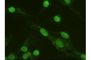 Anti-MAPK6 mouse monoclonal antibody (ABIN2452376) immunofluorescent staining of HeLa cells transiently transfected by pCMV6-ENTRY MAPK6 (RC201597) (MAPK6 抗体  (AA 345-721))