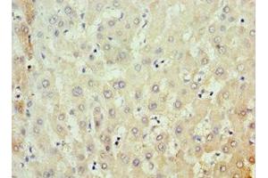 Immunohistochemistry (IHC) image for anti-Meckel Syndrome, Type 1 (MKS1) (AA 150-300) antibody (ABIN7159091)