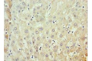 Immunohistochemistry of paraffin-embedded human liver tissue using ABIN7159091 at dilution of 1:100 (MKS1 抗体  (AA 150-300))