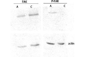 Western Blot (WB) analysis of lysis using FAK antibody. (FAK 抗体  (Thr402, Thr421, Thr423))